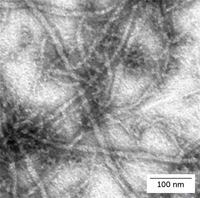 Crisscrossing proteins shown in drying tardigrade cells