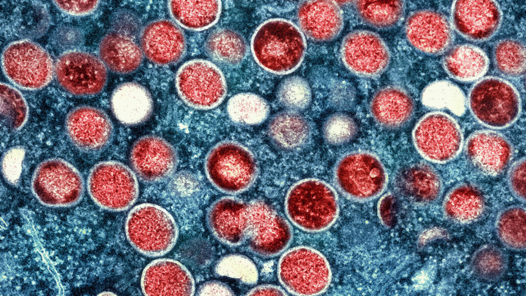 Red Monkeypox particles on the blue background of an infected cell are shown in this colorized transmission electron micrograph.