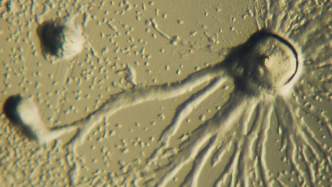 microscope image of tiny Dictyostelium discoideum amoebas shown as dots forming larger blobs