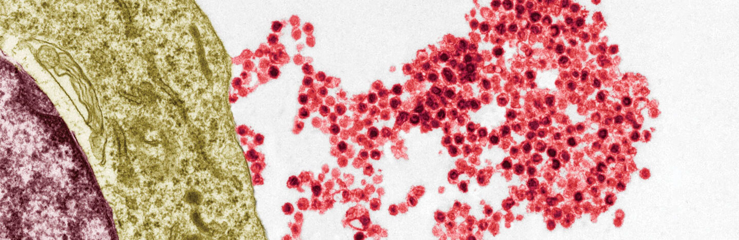 an electron micrograph showing red viruses leaving a B cell