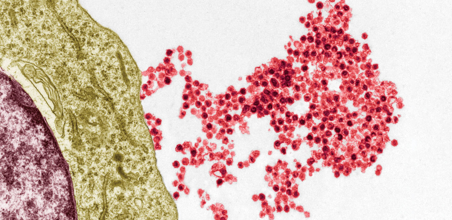 an electron micrograph showing red viruses leaving a B cell