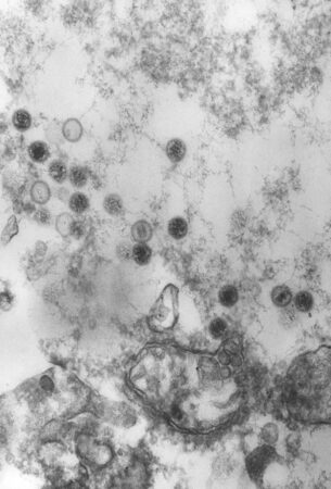 Vista en blanco y negro de un virus de Epstein-Barr bajo un microscopio electrónico de barrido