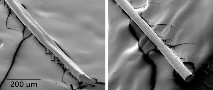 composite of two microscope images of a hair shaft from a girl with uncombed hair syndrome (left) and a typical hair shaft (right)