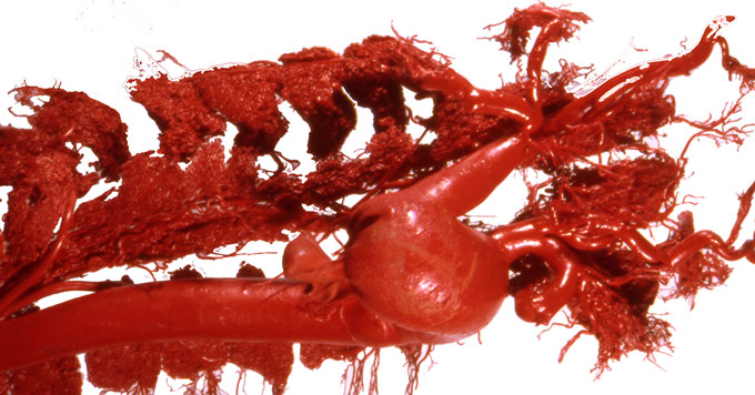 red resin caste of beluga whale blood vessels