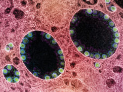 Microscope image of a cell infected with SARS-CoV-2
