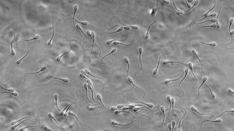 bull sperm swimming in various directions