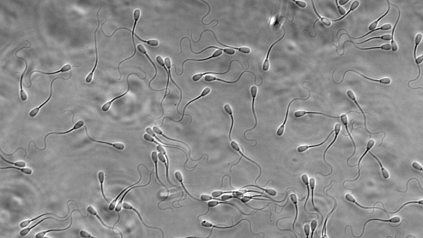 Cooperative sperm outrun loners in the mating race | Science News