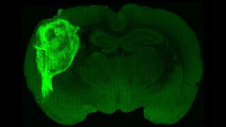 an organoid made of human nerve cells, shown in bright green, on the upper left side of a rat brain, shown in dark green