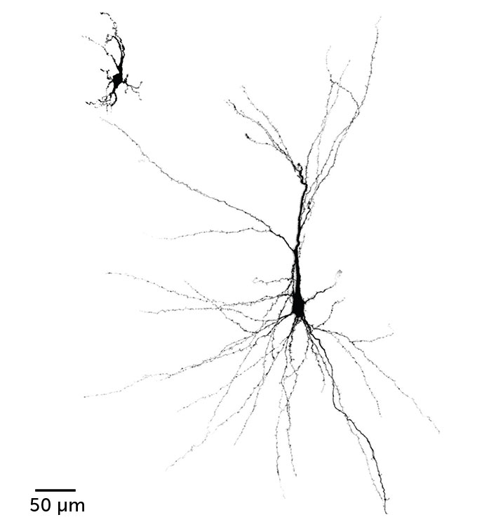 Top left: A human nerve cell grown from an organoid in a lab dish.  It is much smaller, with much shorter 'tendrils' than the nerve cell of an organoid grown in the brain of a rat, which has long, thin 'tendrils' covering most of the image.