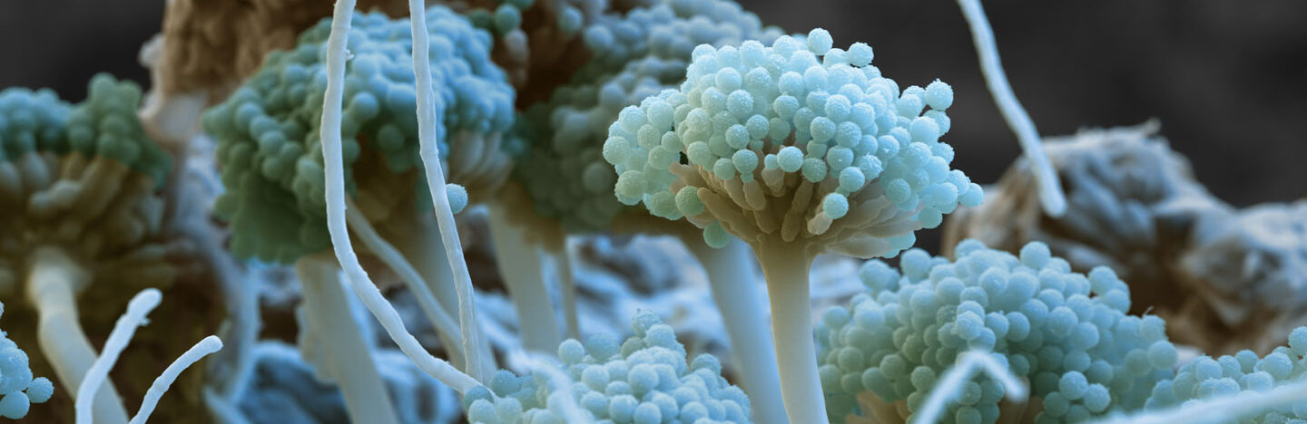 Color-enhanced scanning electron micrograph of the fungus Aspergillus nidulans shows fungal growths that look like broccoli clusters