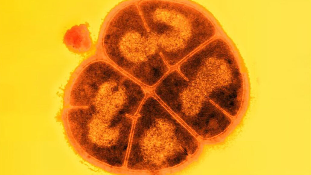A close up of orange bacteria on a yellow background