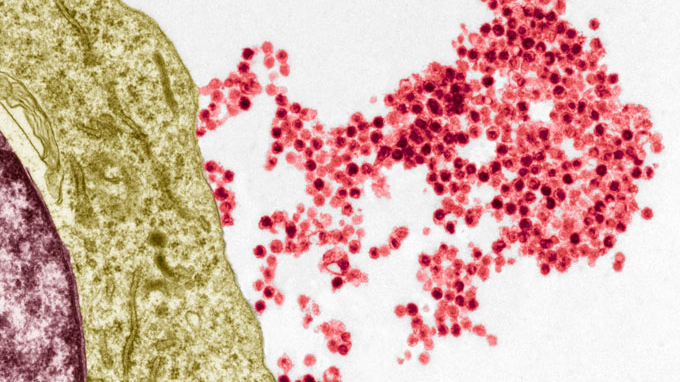 an electron micrograph showing Epstein-Barr viruses emerging from an immune system B cell