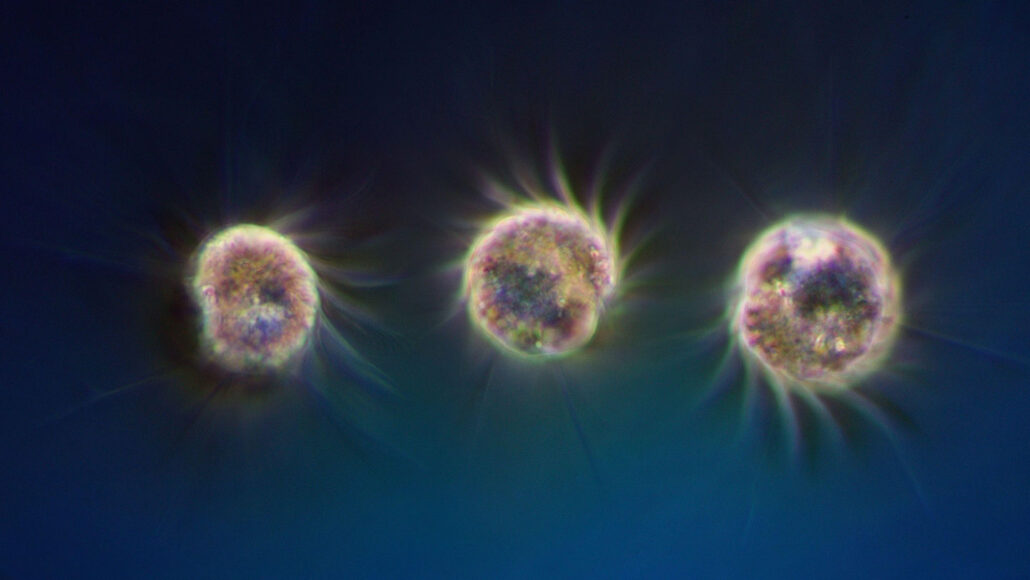 Three Halteria ciliates shown on a blue background