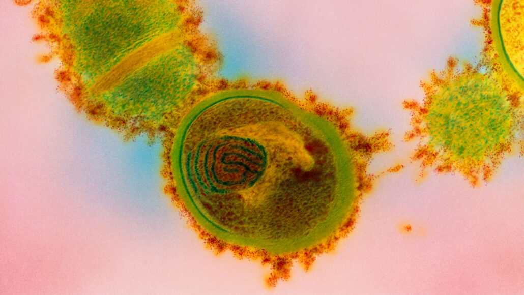 A microscopic image of the bacterial species Streptococcus salivarius.