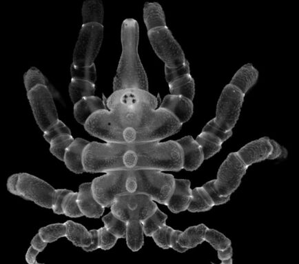 A microscope picture of a juvenile sea spider with its anal tubercle and legs absolutely reformed.