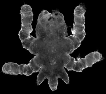 A microscope picture of a younger sea spider with three small stubs on the backside of its physique.