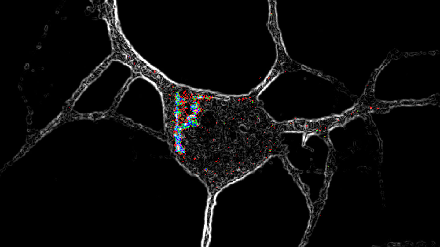 Psychedelics may improve mental health by getting inside nerve cells