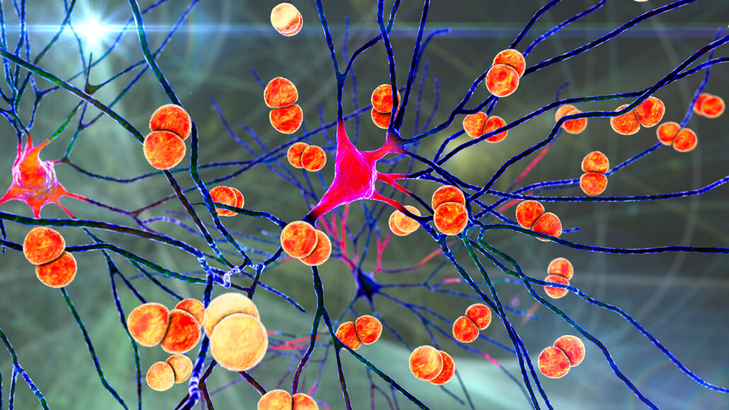 An illustration of Streptococcus pneumoniae bacteria, represented as orange circles, infecting brain cells.