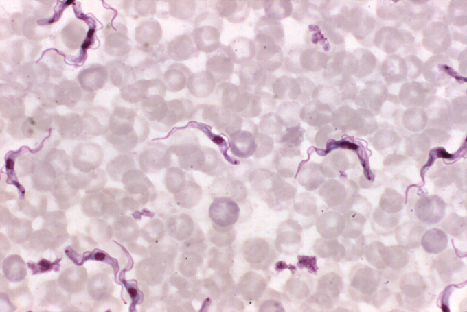 microscopic image of Trypanosoma brucei parasites amid blood cells