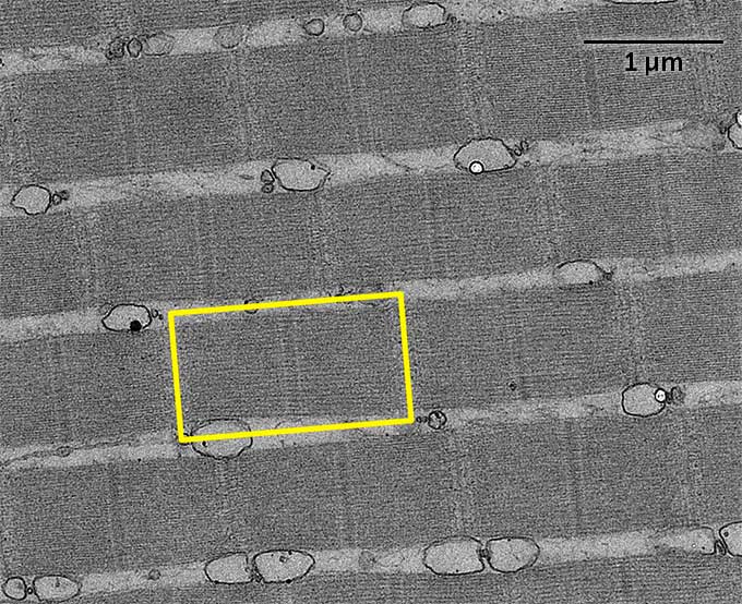 Ein elektronenmikroskopisches Bild von Sarkomeren, die wie graue Rechtecke in einer horizontalen Reihe erscheinen, mit helleren grauen Linien, die sie vertikal trennen.