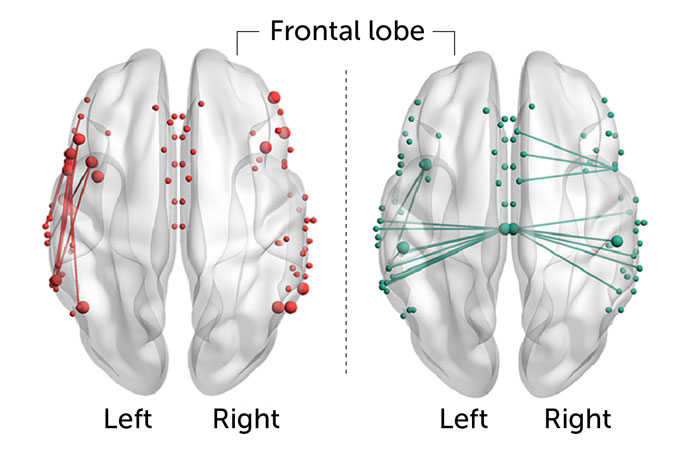 An illustration of two brains next to each other with the frontal lobe at the top of the image and the left and right hemispheres labeled. The brain on the left represents a German native speakers with red lines on the left hemisphere and red dots on the right hemisphere. The brain on the right represents an Arabic native speakers brain with cyan lines connection the two hemispheres and cyan dots scattered throughout both sides.