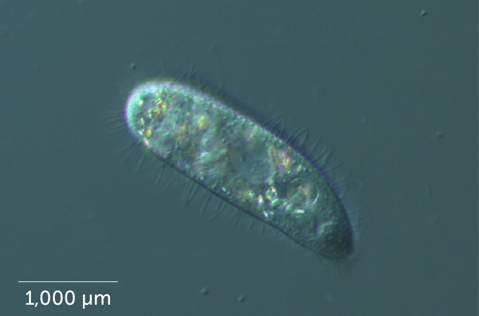 Urchins are dying off across the Caribbean. Scientists now know why 3 A microscope image of Philaster apodigitiformis which looks like a long oval blob on a blue green background.