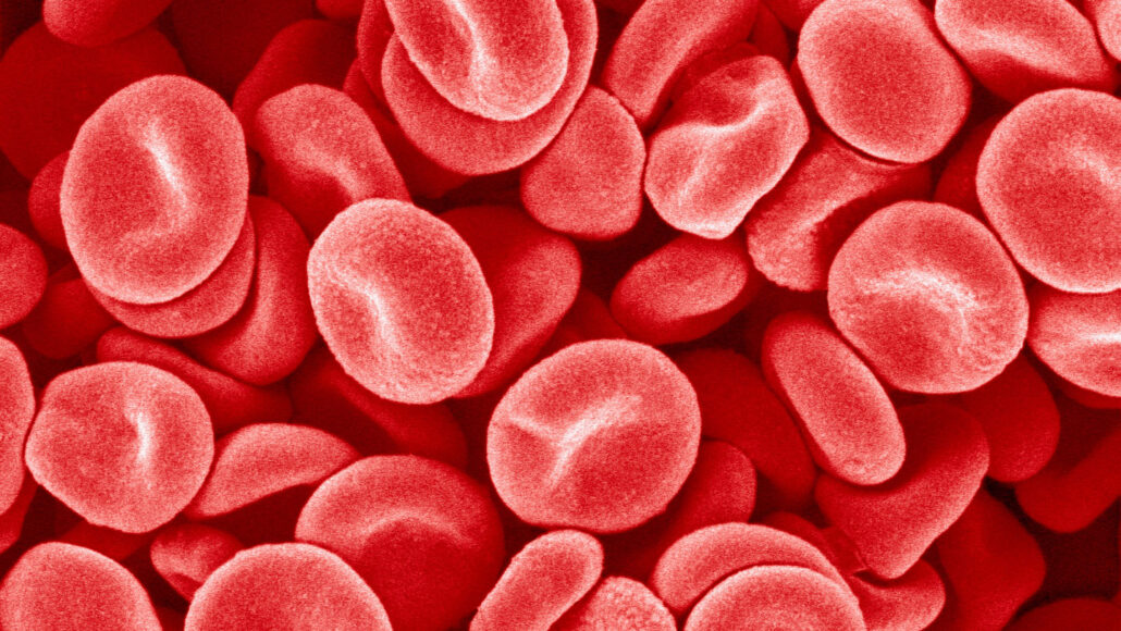 An image of several red blood cells.