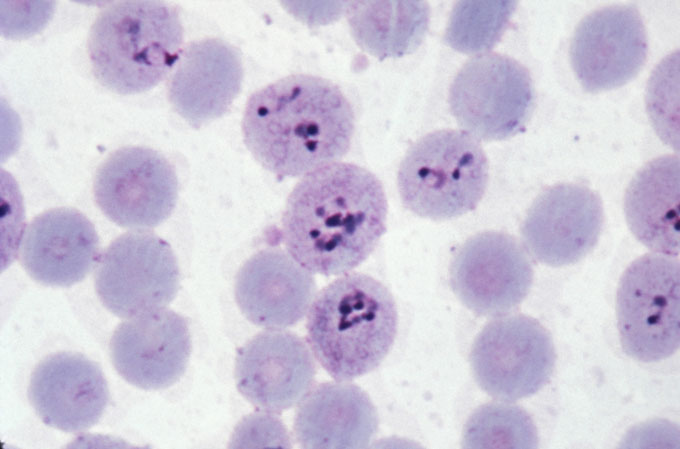 An image of red blood cells with dark spots in the middle on a white background.