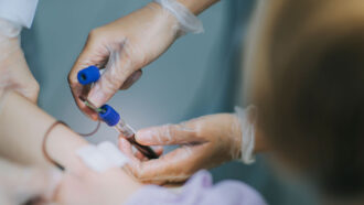 detecting fake news assignment vaccines answers A photo of a nurse taking blood from a patient's arm to screen for iron deficiency and anemia.