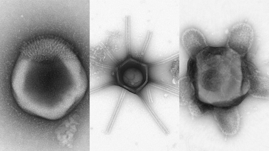 A collection of three microscopic images of potential giant viruses.