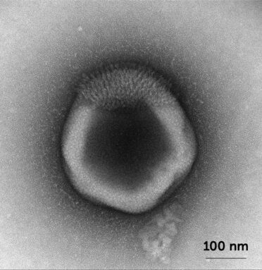 A microscopic image of the giant virus particle nicknamed haircut which appears to have fibers attached at the top.