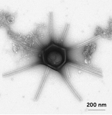 A microscopic image of the giant virus nicknamed 