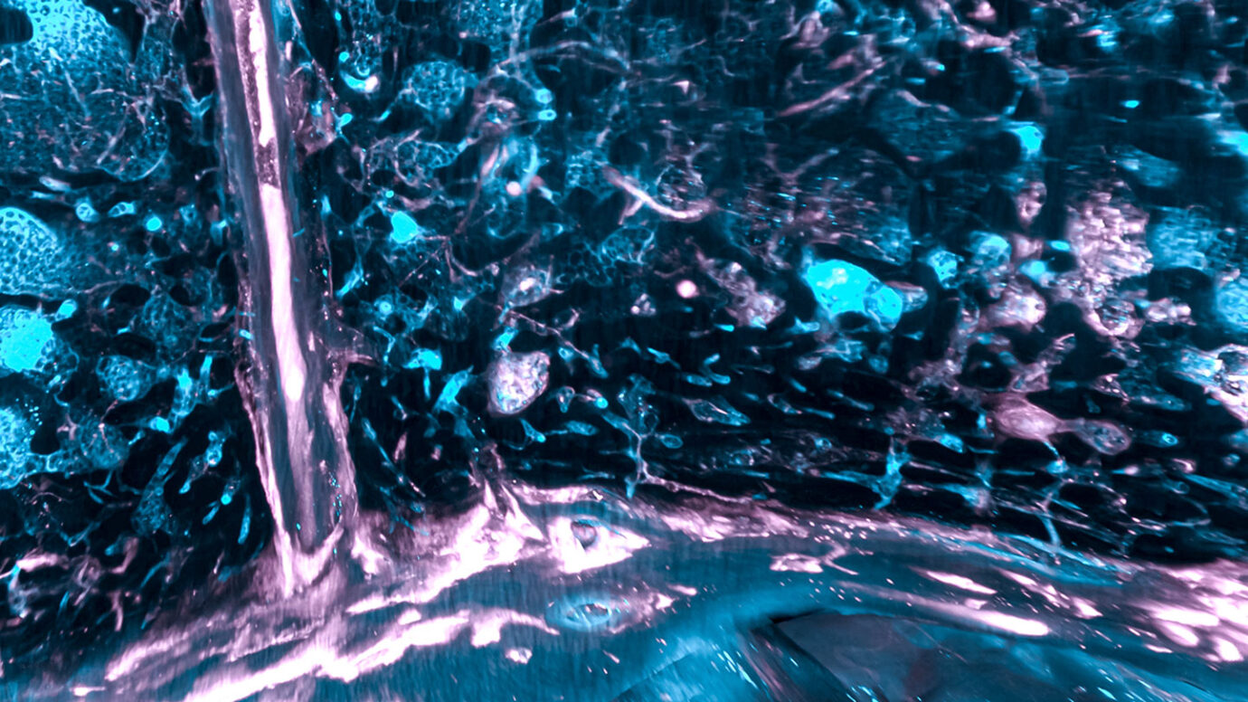 This week in Zika An anniversary, how the virus kills brain cells and