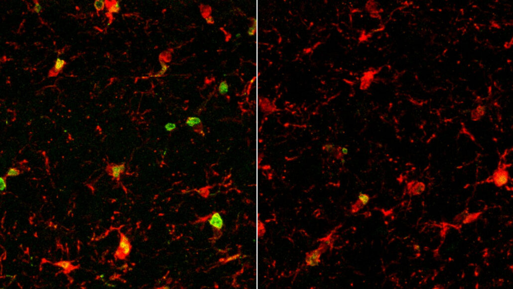 Side-by-side of stained microscope images showing brains of old mice, where scientists found that age-related inflammation (stained green and yellow) in immune cells was prevalent in untreated mice (left) but was greatly reduced in mice treated with PF4 (right).