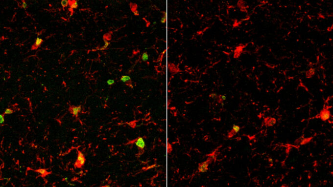 interesting scientific papers 2021 Side-by-side of stained microscope images showing brains of old mice, where scientists found that age-related inflammation (stained green and yellow) in immune cells was prevalent in untreated mice (left) but was greatly reduced in mice treated with PF4 (right).