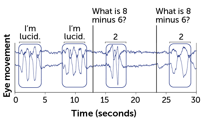 graphic showing a lucid dreamer’s eye movements during a mid-dream conversation that lasted 30 seconds