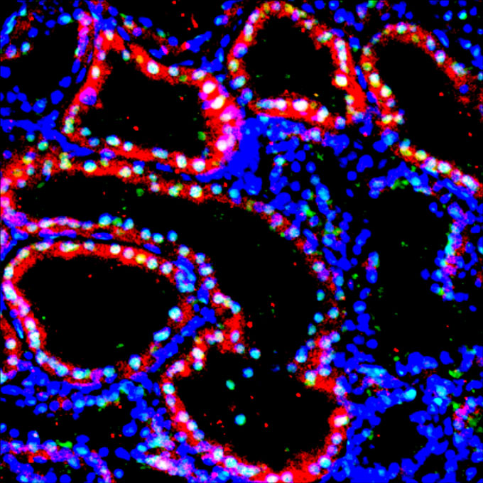 An image of red and blue cells found in a kidney grown in a pig embryo.