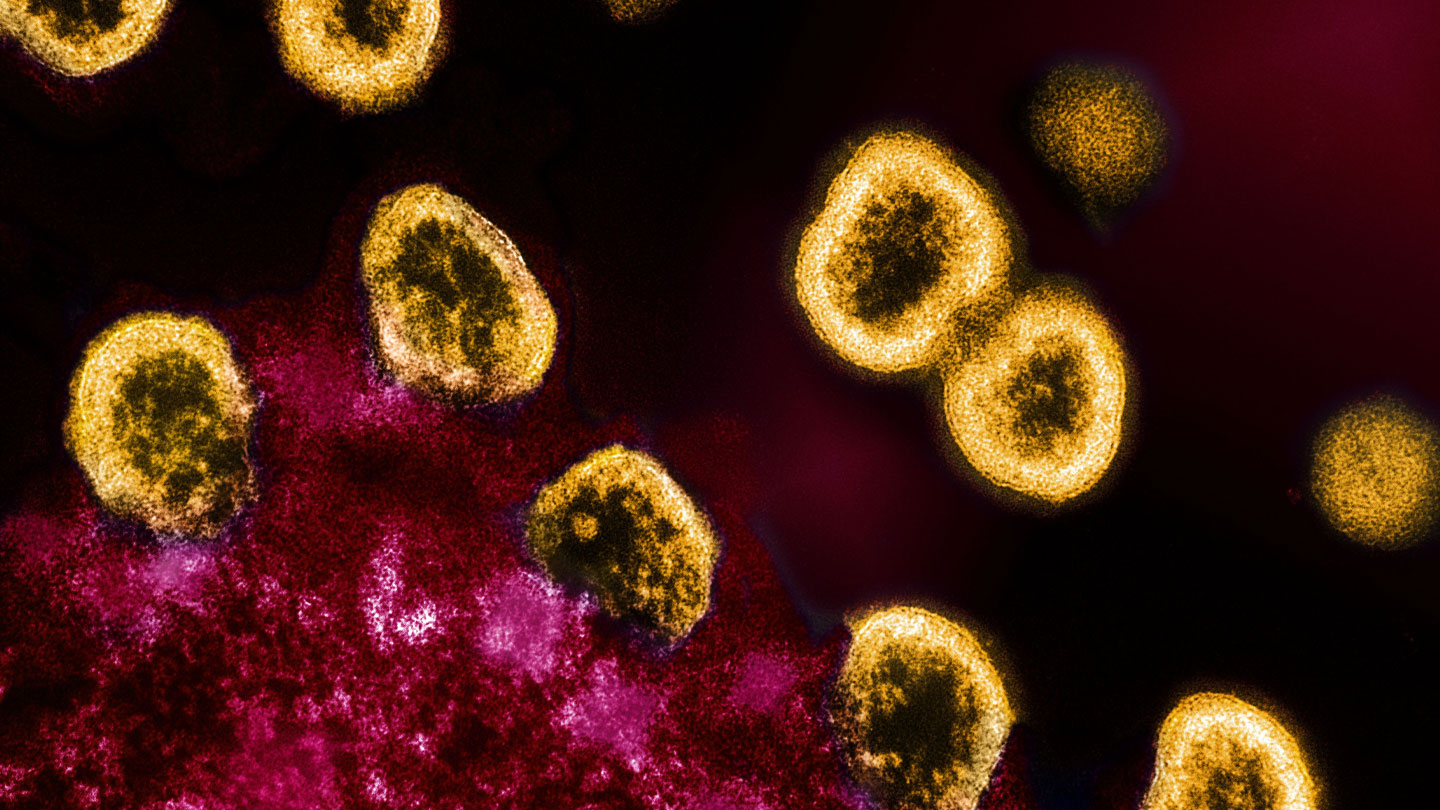 Спящий вич. Вирусный гепатит под микроскопом. Вирус гепатита под микроскопом. Гепатит с под микроскопом. Гепатит д под микроскопом.