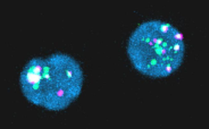 An image of two blue colored cells with green and magenta spots in the middle.
