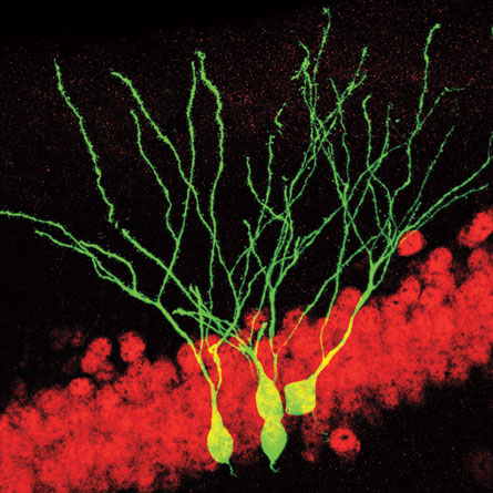 Newborn neurons (green, above) help mice build memories. Other research shows that antidepressants may help trigger neuron generation in the hippocampus.