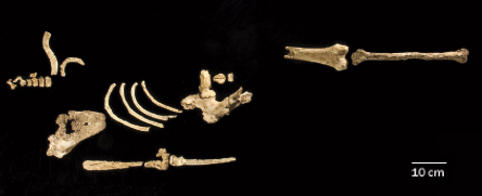 Bones shown on black background.