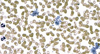 Plasmodium falciparum