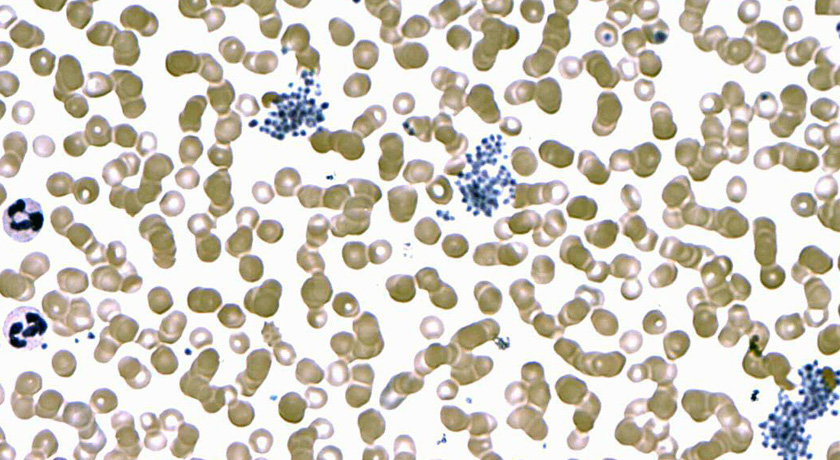 Plasmodium falciparum