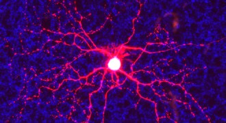 retinal ganglion cell