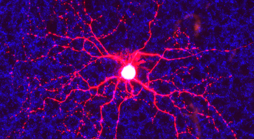 retinal ganglion cell
