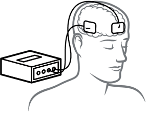 illustration of transcranial direct current stimulation