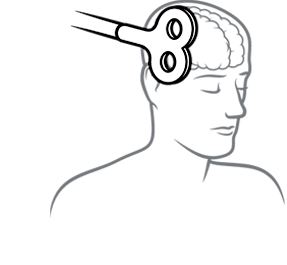 illustration of transcranial magnetic stimulation