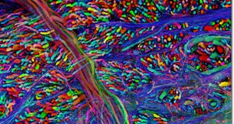 brainstem cells and connections