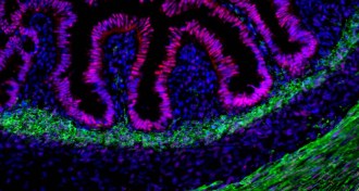 iny specks of human intestinal tissue (stained pink)