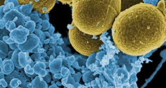 S. aureus cells and white blood cells